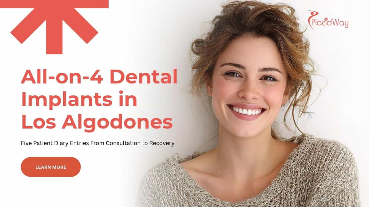 All-on-4 dental implants in Los Algodones