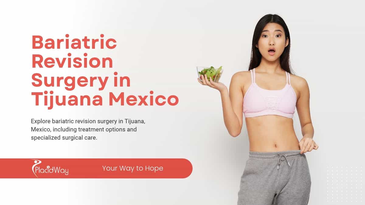 Bariatric Revision Surgery in Tijuana Mexico