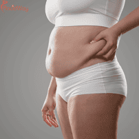 How Much Does Bariatric Surgery Cost in India?