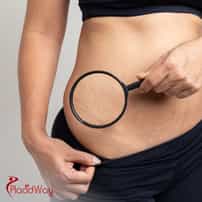 Where can I get a mommy makeover in the Dominican Republic?