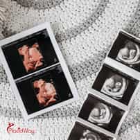 Which Country Is Considered The Best Choice For IVF Treatment Abroad?