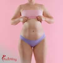 ¿Qué clínicas ofrecen liposucción en Colombia?