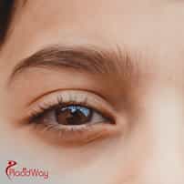 What Is The Price Of Lazy Eye Surgery?