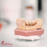 How Much Do All on 4 Dental Implants Cost in Thailand in 2025?