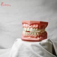 Is It Safe to Get Dental Implants in Colombia?