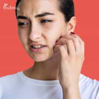 How to manage lupus flare ups with treatment in China?
