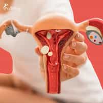 ¿Es seguro hacerse una labioplastia en México?