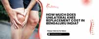 How Much Does Unilateral Knee Replacement Cost In Bengaluru India?