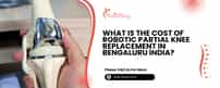 What Is The Cost Of Robotic Partial Knee Replacement In Bengaluru India?