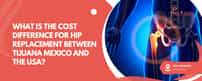 What Is The Cost Difference For Hip Replacement Between Tijuana Mexico And The Usa?