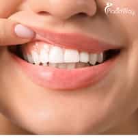 Is Laser Gum Contouring Safe in Korean Clinics?