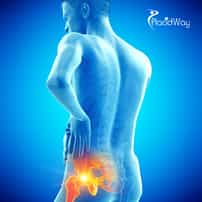 How Advanced Is Hip Replacement Surgery In India?