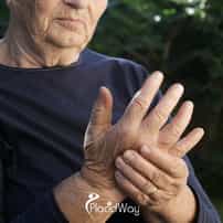 Why are image-guided stem cell injections in Colombia more effective for treating severe arthritis pain?