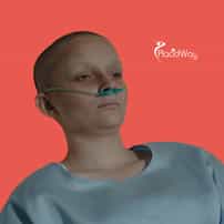 ¿Por qué algunos pacientes con melanoma dejan de responder a la quimioterapia y qué sucede después?