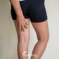 What Are the Risks of Limb Lengthening Surgery in Turkey for US Patients?