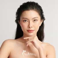 Chin Augmentation in Gangnam, South Korea: Is It Right for You?