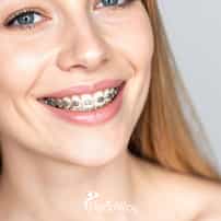 How Much Does Dental Braces Cost in Egypt?