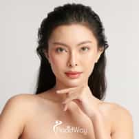 How Much Does Double Eyelid Surgery Cost in Vietnam?