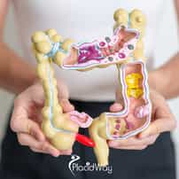 How Much Does it Cost to Treat Colon Cancer in Turkey?