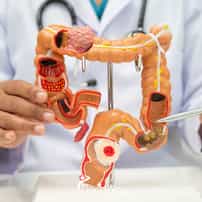 What Alternative Therapies Are Available for Colon Cancer in Mexico?