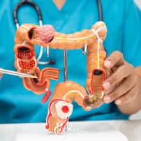 Is Ozone Therapy Effective for Colon Cancer Treatment in Mexico?