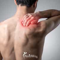How Much Does Shoulder Replacement Cost in Guadalajara, Mexico?