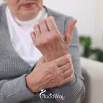 How Much Does Carpal Tunnel Surgery Cost in Mexico?