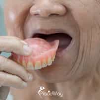 Dentures in Gangnam, South Korea: Removable vs Implant-Supported Teeth Options