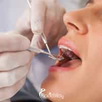 Orthodontic Treatment in Gangnam, South Korea: Braces With Cross-Border Follow-Up