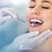 Dental Inlays and Fillings in Gangnam, South Korea: Inlay vs Filling vs Crown