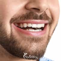Successful Dental Procedure at Sani Dental Group Los Algodones, Mexico