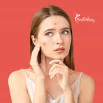 Achieving Skin Balance: How US Patient Jessica Tried Immune-Level Strategies in Mexico