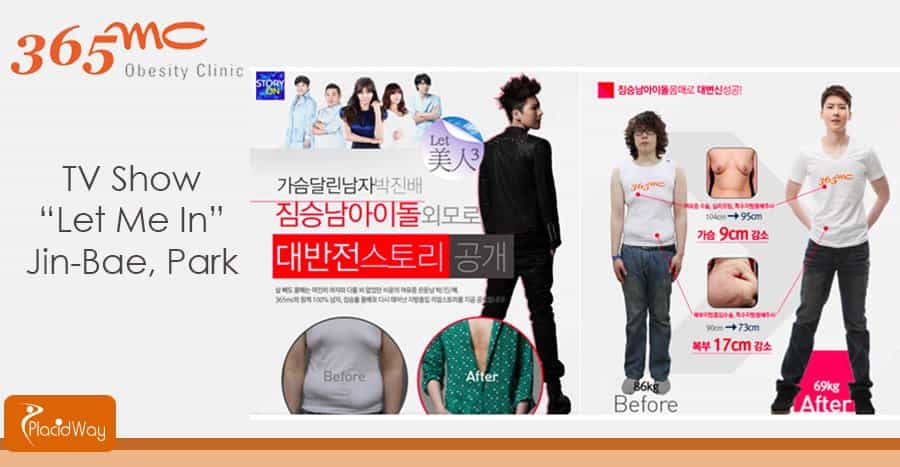 Before and After Surgery - Liposuction Clinic - Seoul, South Korea Before and After Surgery - Liposuction Clinic - Seoul, South Korea