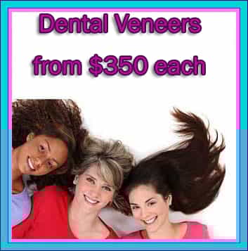 Dental Veneers Cost in Mexico Dental Veneers Cost in Mexico