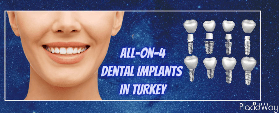 all on 4 dental implants in turkey all on 4 dental implants in turkey