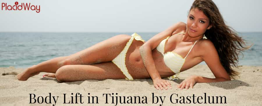 Body Lift in Tijuana by Gastelum