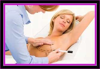 Plastic Surgery Facts