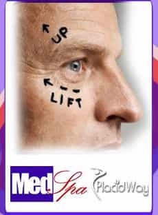 Reconstructive-Surgery-Picture-Placidway-Man