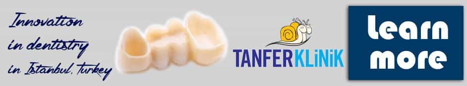 corone dentali a Istanbul, Turchia dental crowns in istanbul turkey
