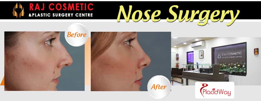 Before and After Images Nose Surgery India