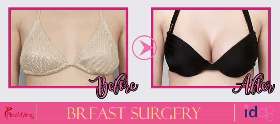 Breast Surgery