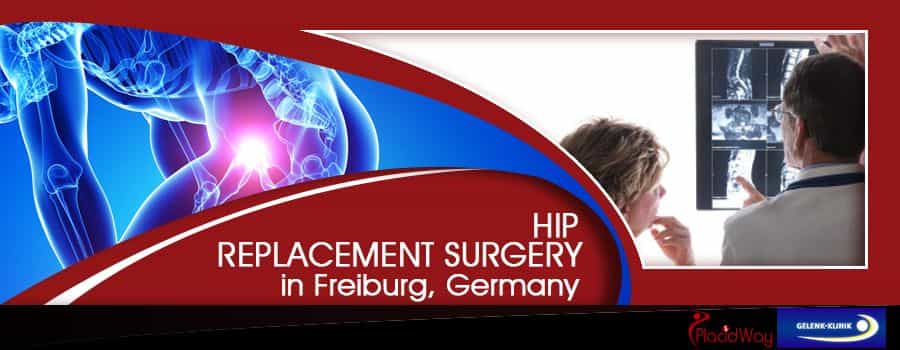 Hip Replacement in Freiburg, Germany