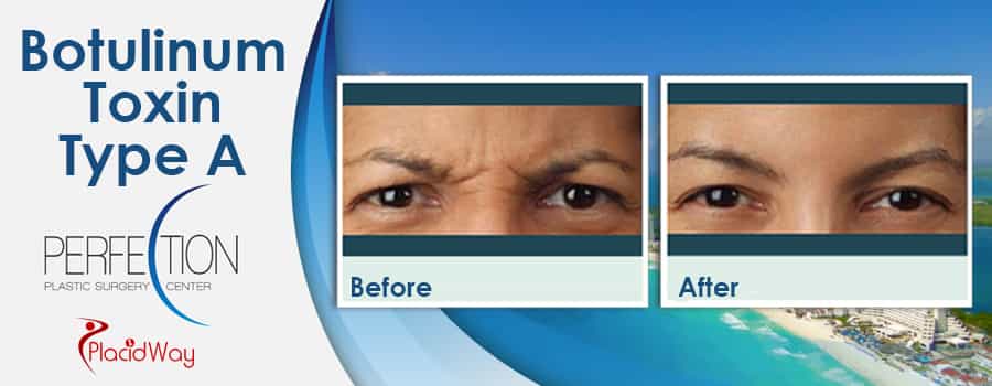 Before and After Cosmetic Procedure in Cancun Mexico Before and After Cosmetic Procedure in Cancun Mexico