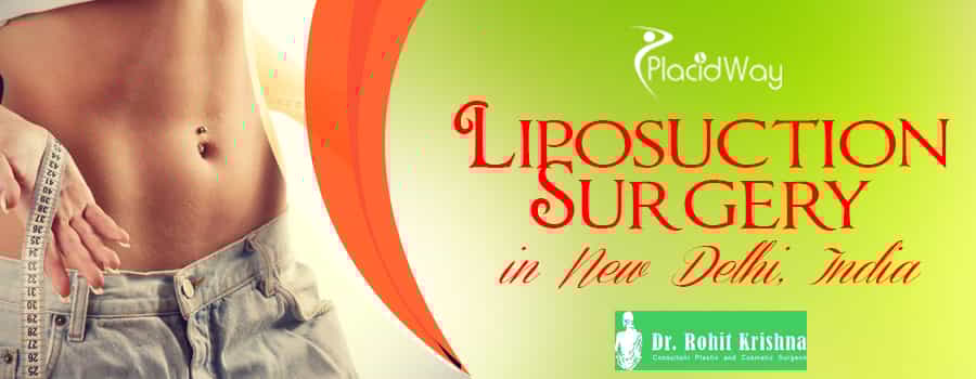 Liposuction Package in New Delhi, India