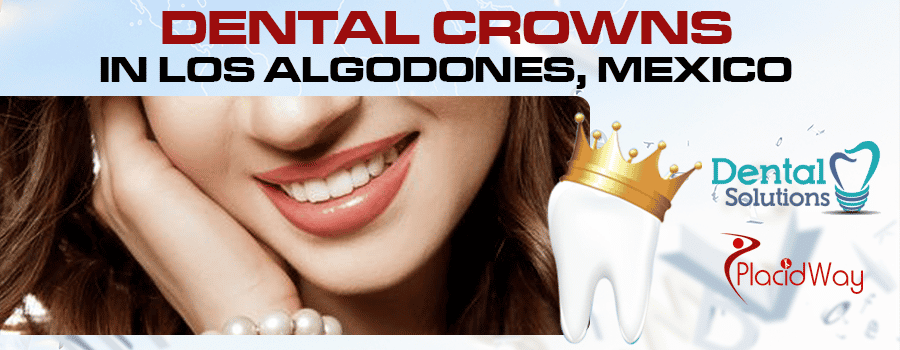 Paquete de Coronas Dentales en Los Algodones, México Dental Crowns Package in Los Algodones, Mexico