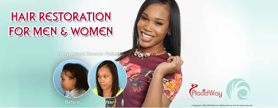 Antes y después del procedimiento NeoGraft en EE. UU. Before and After NeoGraft Procedure in US