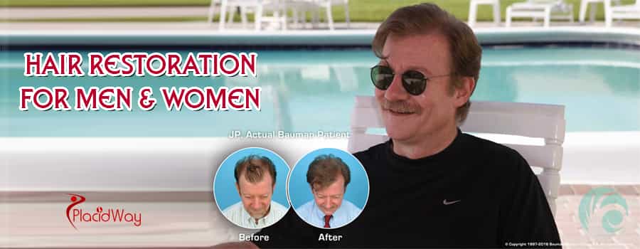 Testimonio de un paciente antes y después de un trasplante de cabello en Estados Unidos Patient Testimonial Before and After Hair Transplantation in US