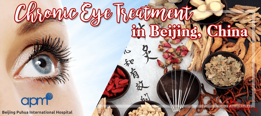 Stem Cell Transplantation + Mouse Nerve Growth Factor + TCM Stem Cell = Effective Chronic Eye Treatment