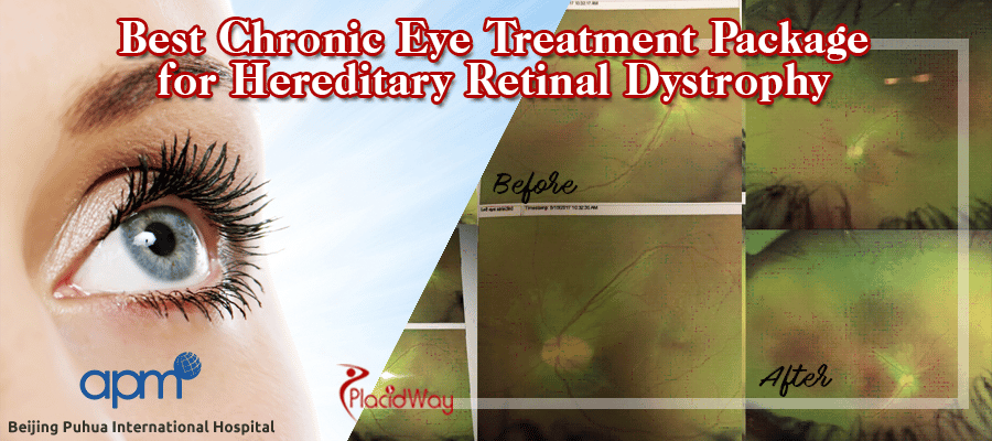 Chronic Eye Treatment Package for Hereditary Retinal Dystrophy