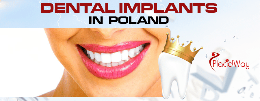 Dental Implants Procedures in Poland Dental Implants Procedures in Poland